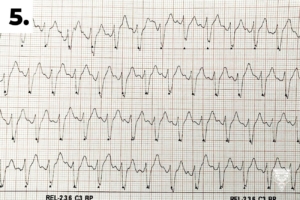 5. EKG při předání